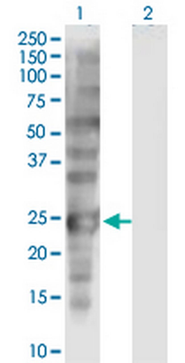 SSX1 Antibody in Western Blot (WB)