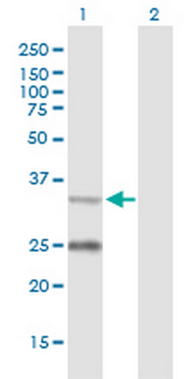 STAR Antibody in Western Blot (WB)