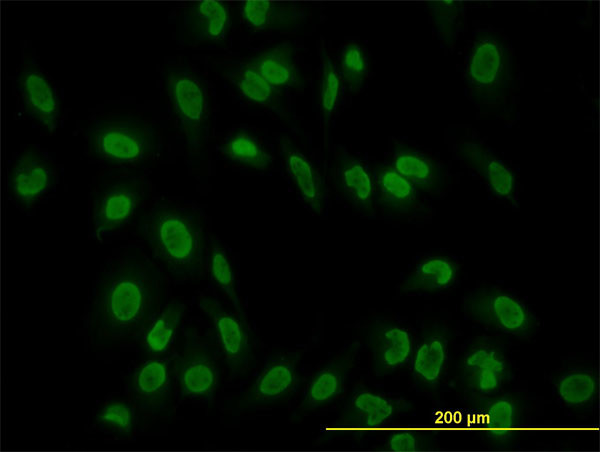 TAF11 Antibody in Immunocytochemistry (ICC/IF)