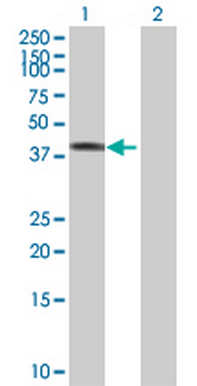 TCP10 Antibody in Western Blot (WB)