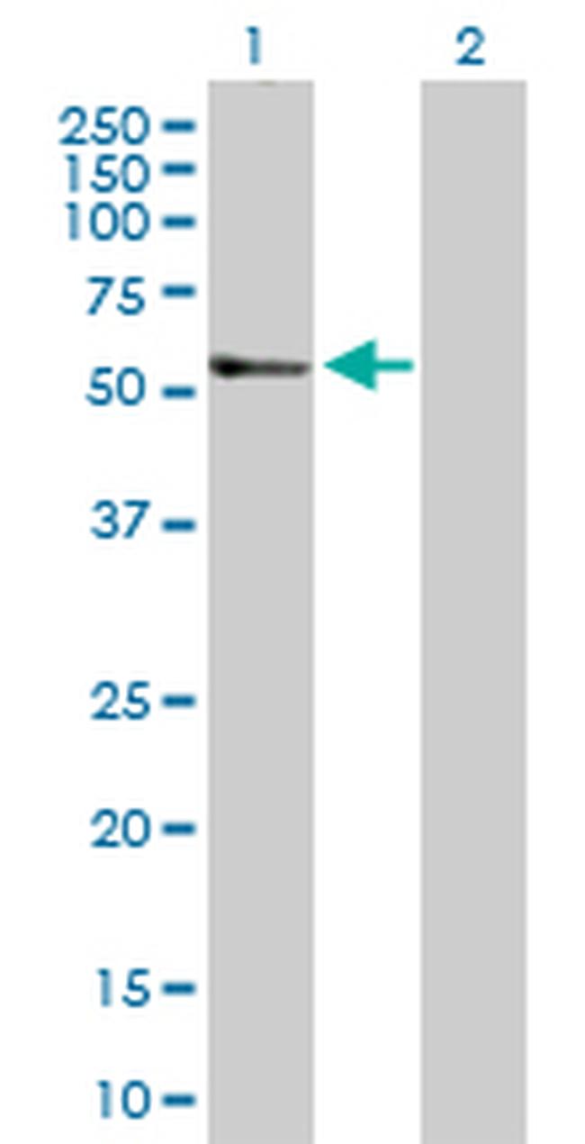 TGFB2 Antibody in Western Blot (WB)