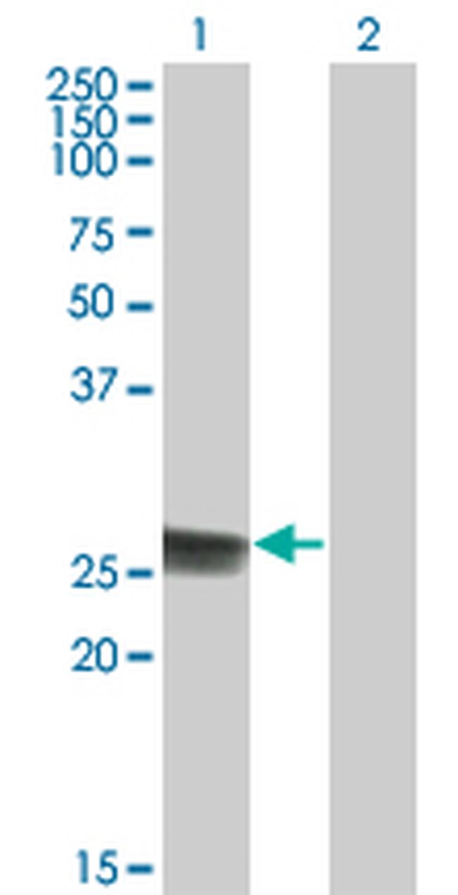 TK1 Antibody in Western Blot (WB)