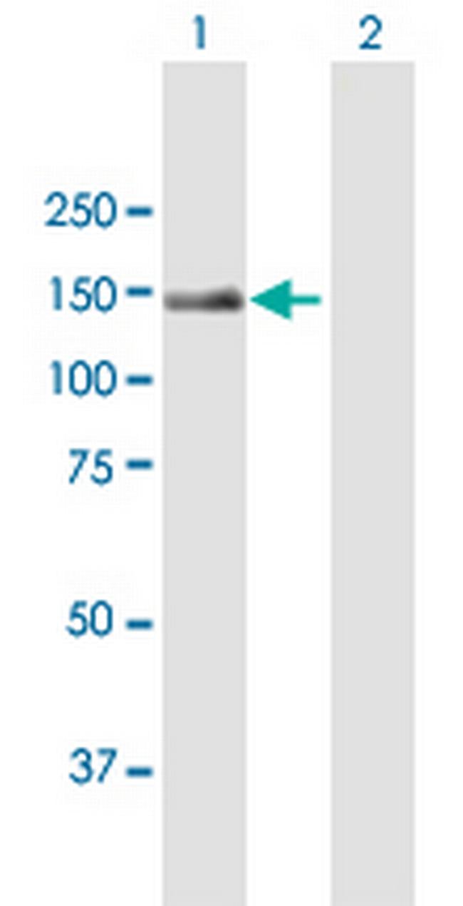 TRAPPC10 Antibody in Western Blot (WB)