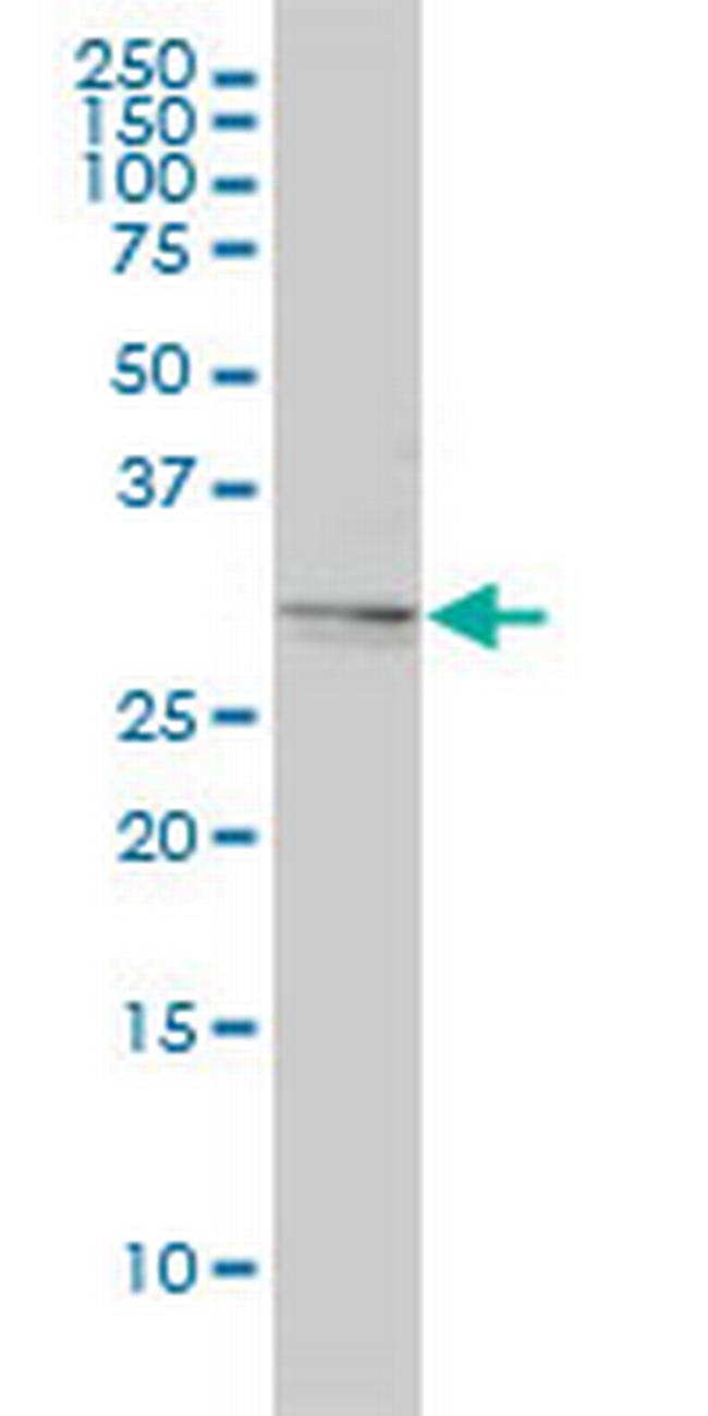 TPM4 Antibody in Western Blot (WB)