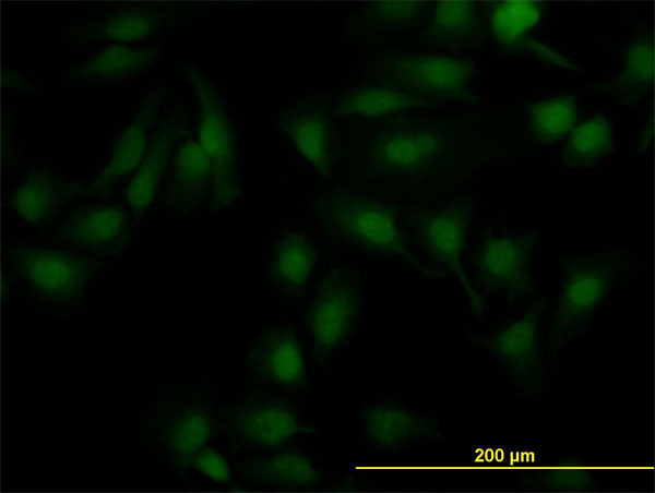 NR1H2 Antibody in Immunocytochemistry (ICC/IF)