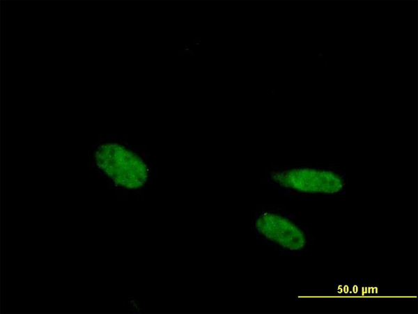 VDR Antibody in Immunocytochemistry (ICC/IF)