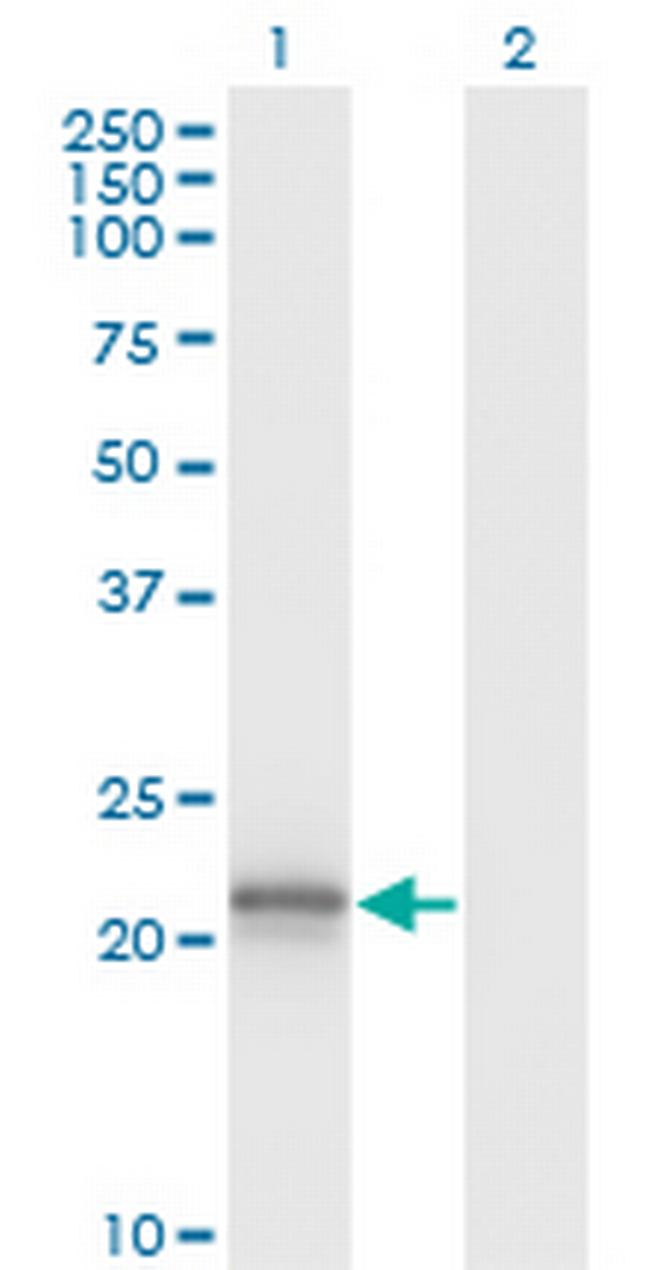 VHL Antibody in Western Blot (WB)