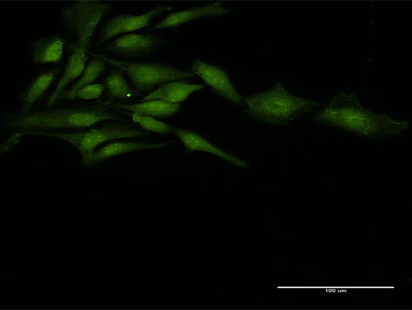 ZFP36 Antibody in Immunocytochemistry (ICC/IF)