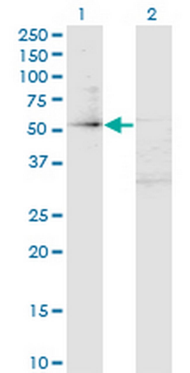 ZFP161 Antibody in Western Blot (WB)