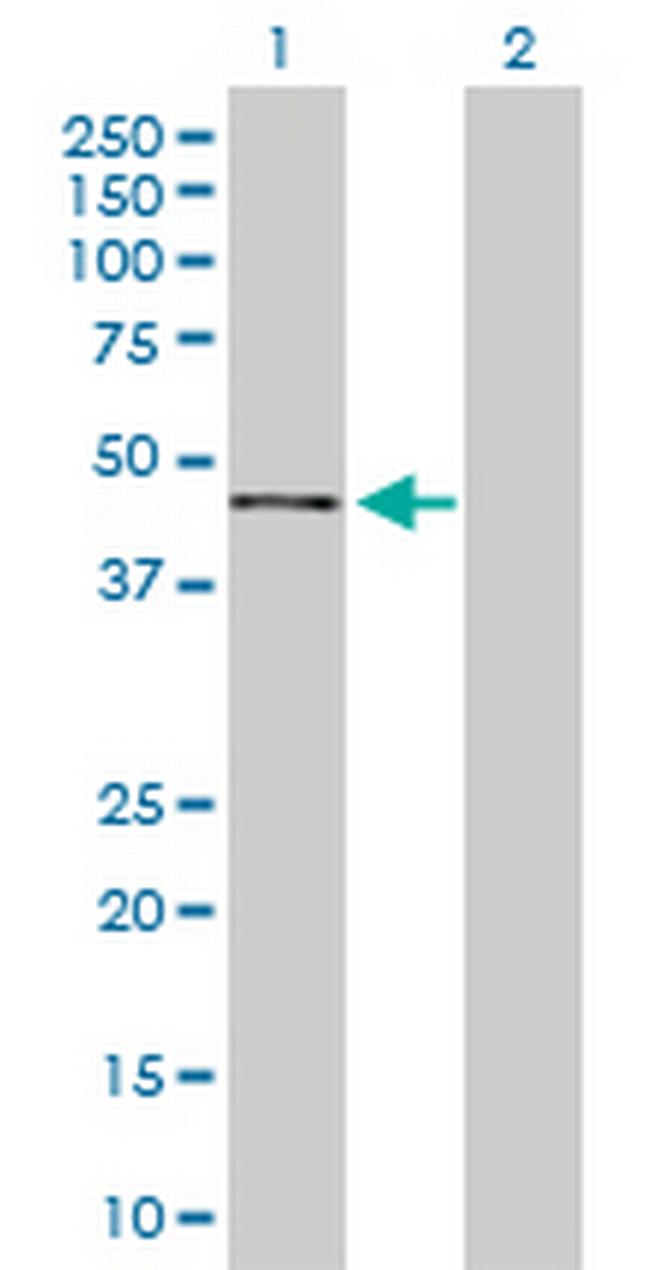 NPHS2 Antibody in Western Blot (WB)