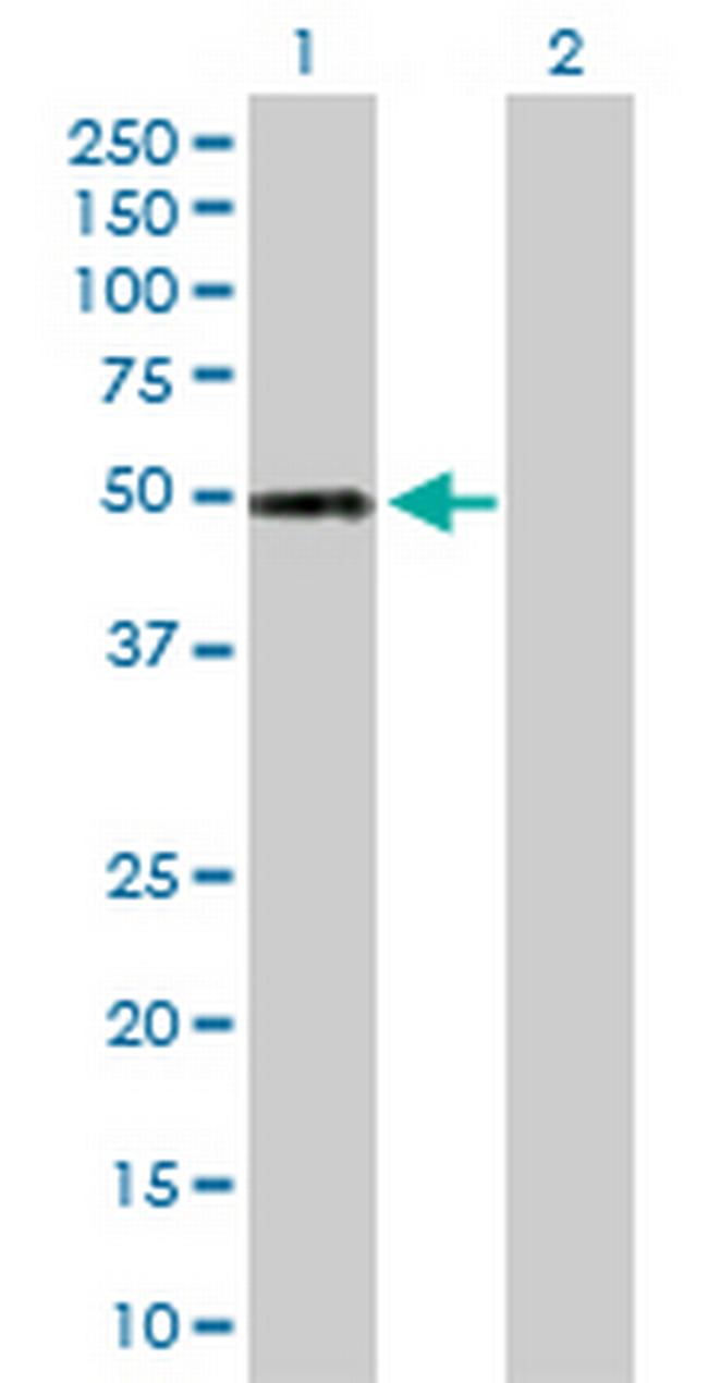 ALDH5A1 Antibody in Western Blot (WB)