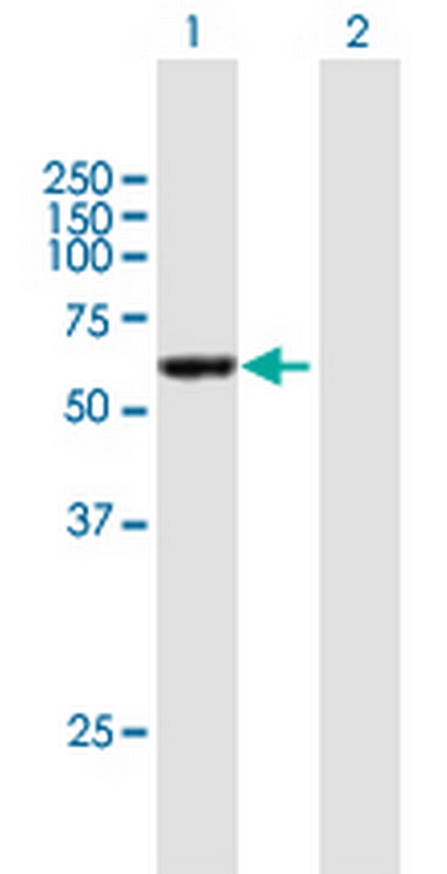 CCDC6 Antibody in Western Blot (WB)