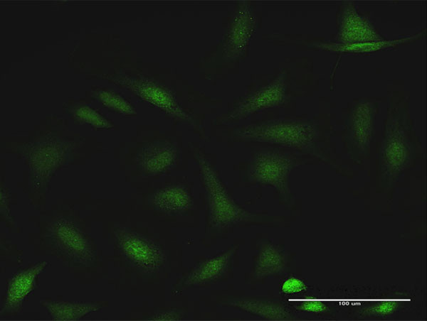 CCDC6 Antibody in Immunocytochemistry (ICC/IF)