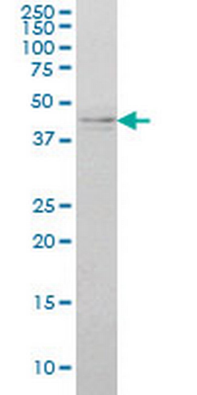 IKBKG Antibody in Western Blot (WB)