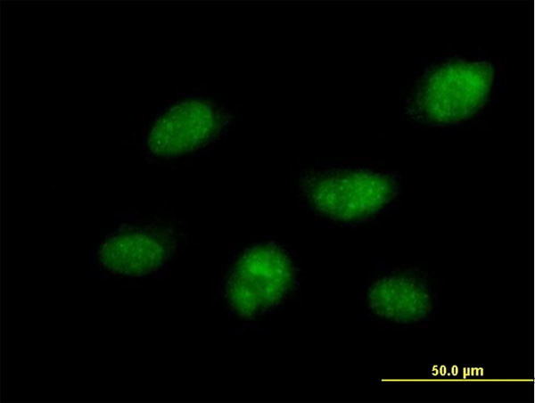 CDC14B Antibody in Immunocytochemistry (ICC/IF)