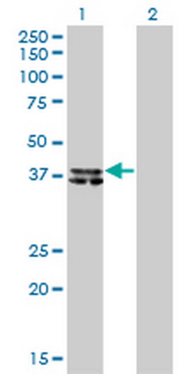 B4GALT4 Antibody in Western Blot (WB)