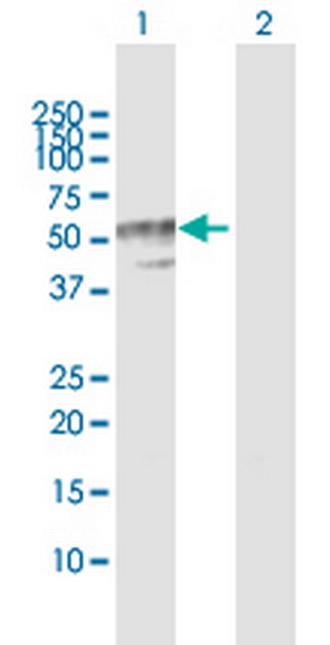 B4GALT3 Antibody in Western Blot (WB)