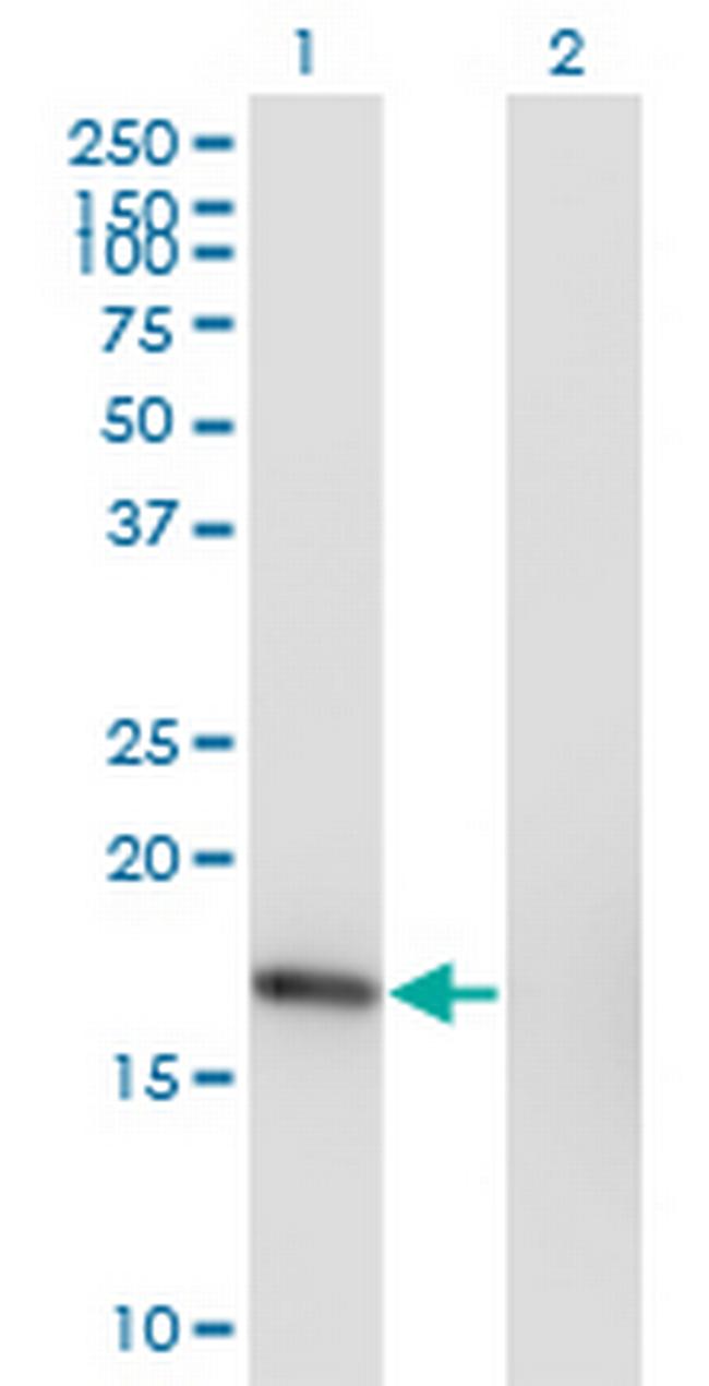 SNX3 Antibody in Western Blot (WB)