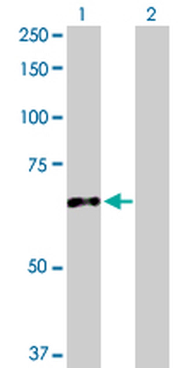 CES2 Antibody in Western Blot (WB)