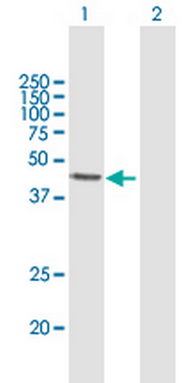 ALKBH1 Antibody in Western Blot (WB)