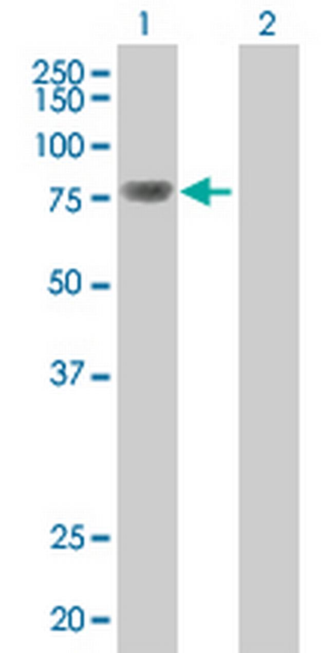 TOP3B Antibody in Western Blot (WB)