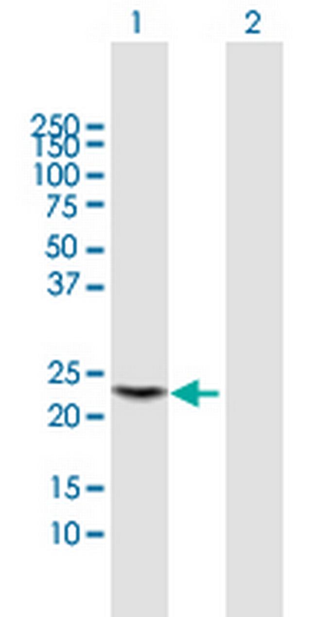 PGLYRP1 Antibody in Western Blot (WB)