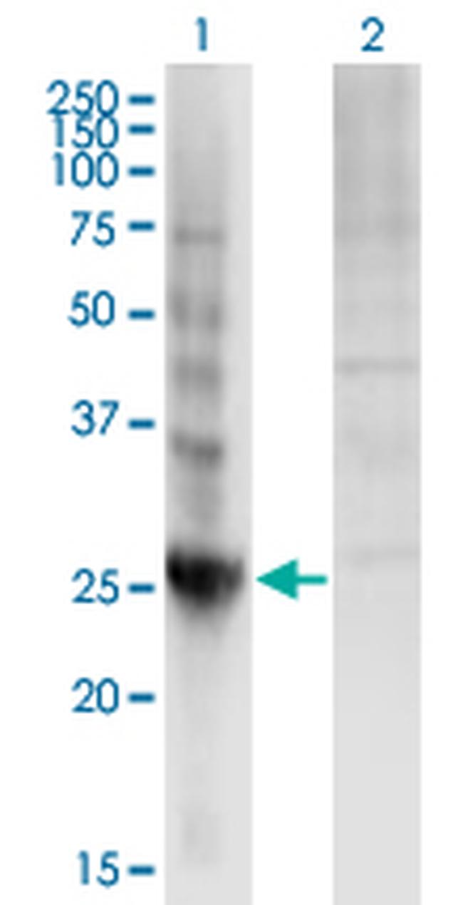 DIRAS3 Antibody in Western Blot (WB)