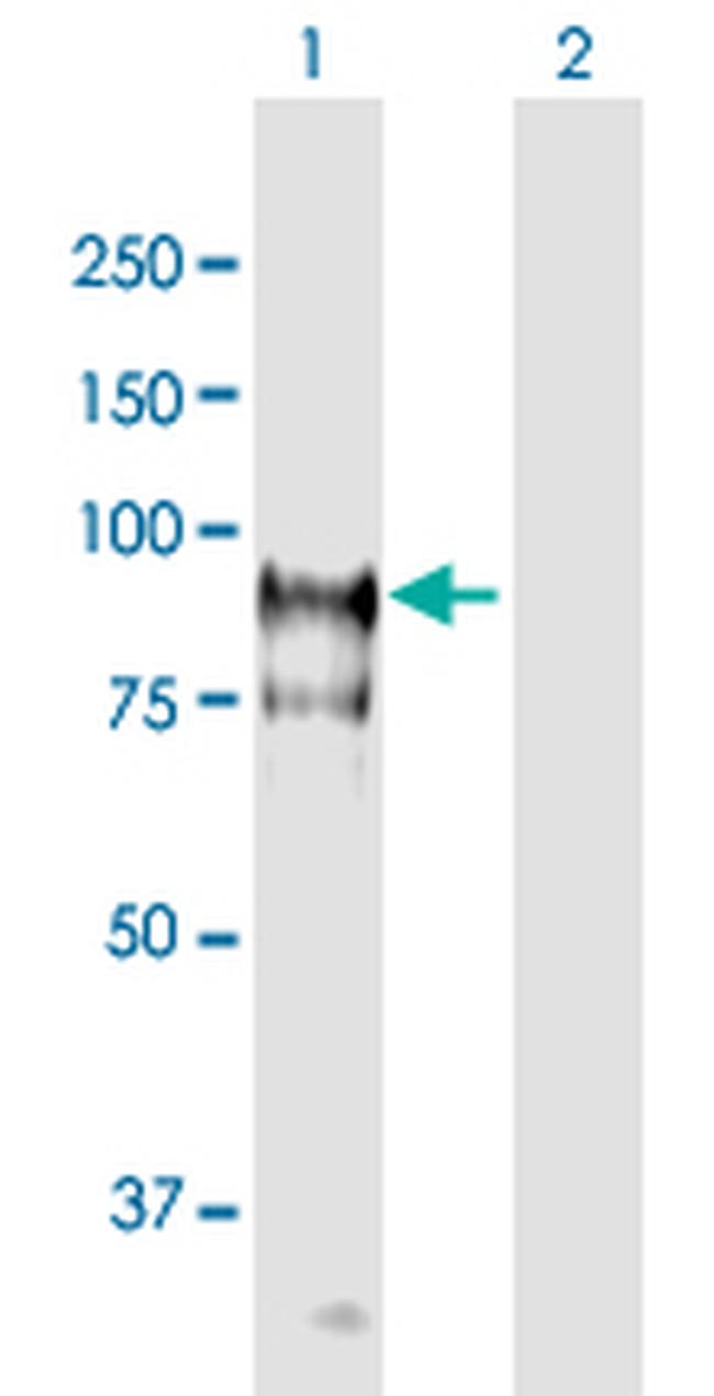 HGS Antibody in Western Blot (WB)