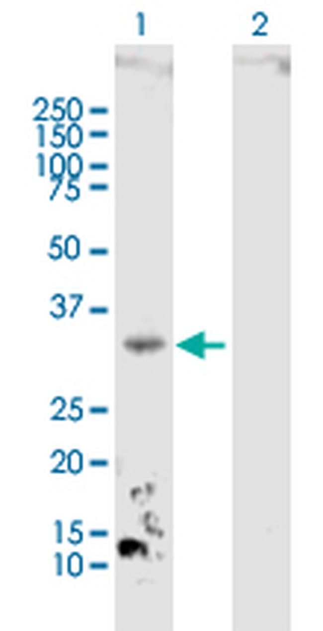 DHRS3 Antibody in Western Blot (WB)