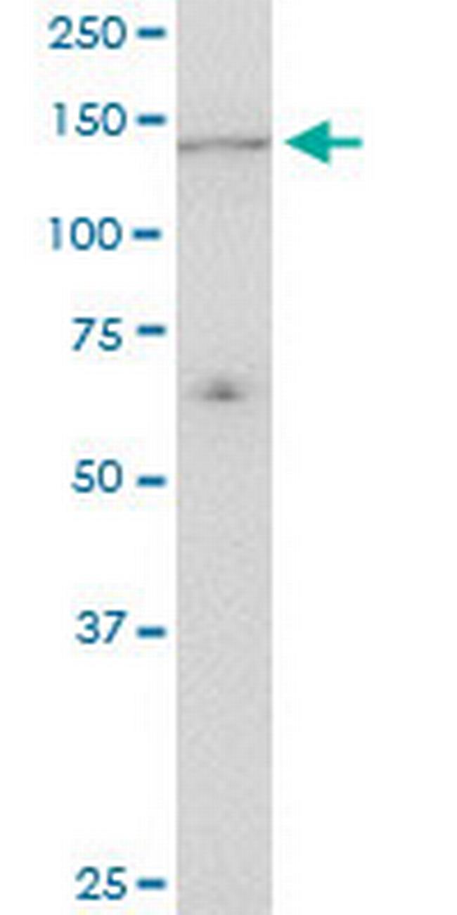 UBE4A Antibody in Western Blot (WB)