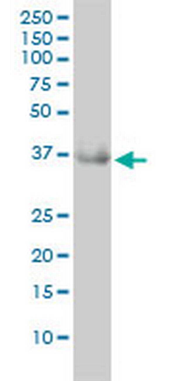 GRHPR Antibody in Western Blot (WB)