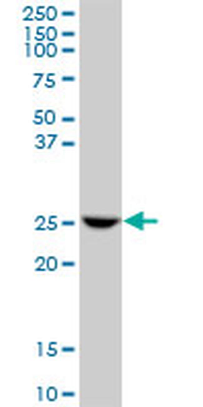 GSTO1 Antibody in Western Blot (WB)
