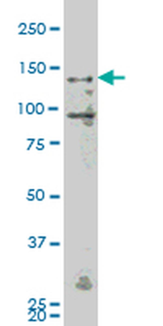 MAP4K4 Antibody in Western Blot (WB)