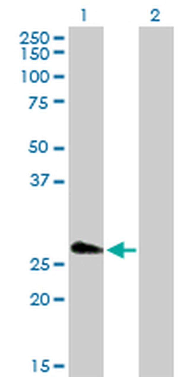 FHL5 Antibody in Western Blot (WB)