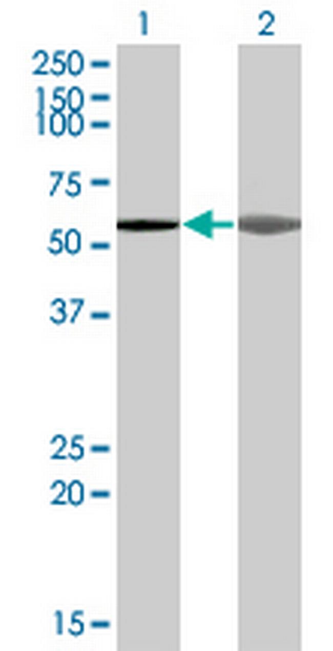 AKAP5 Antibody in Western Blot (WB)