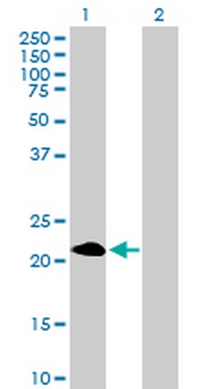 PAGE4 Antibody in Western Blot (WB)