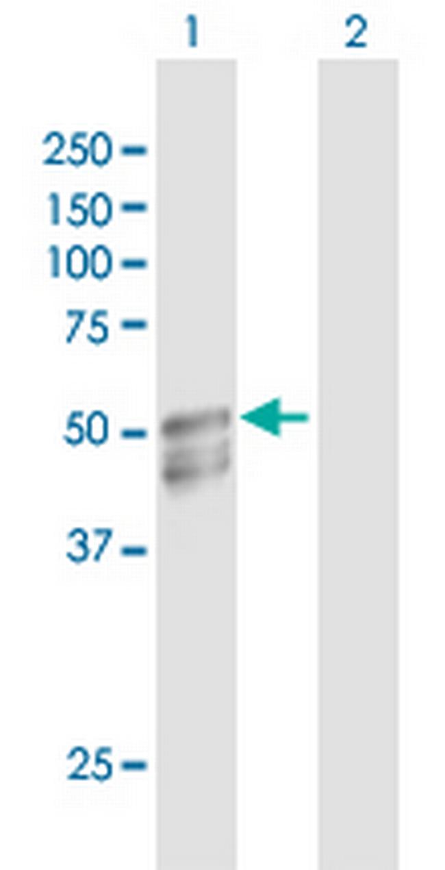 GAL3ST1 Antibody in Western Blot (WB)