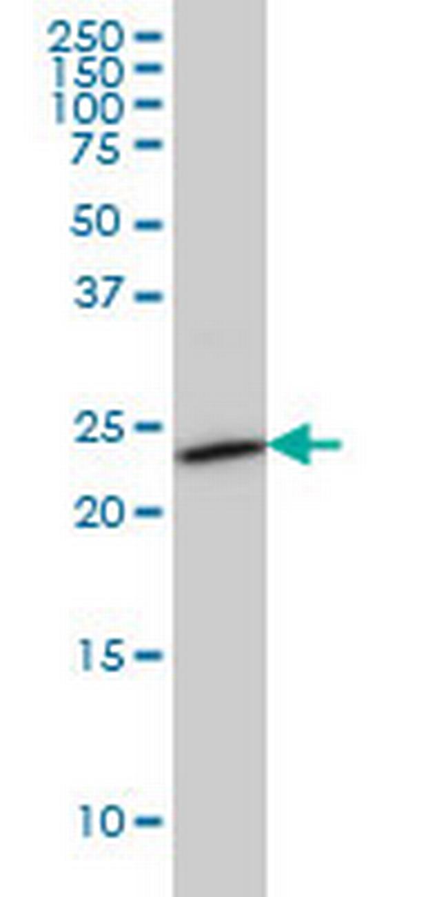 SEC22L1 Antibody in Western Blot (WB)