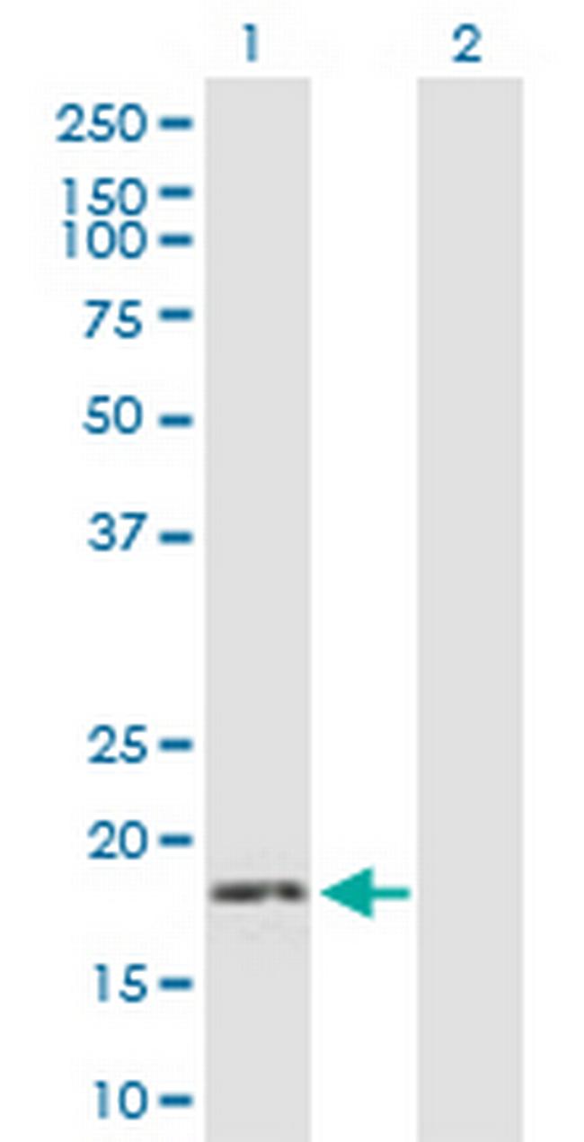 GUCA1C Antibody in Western Blot (WB)