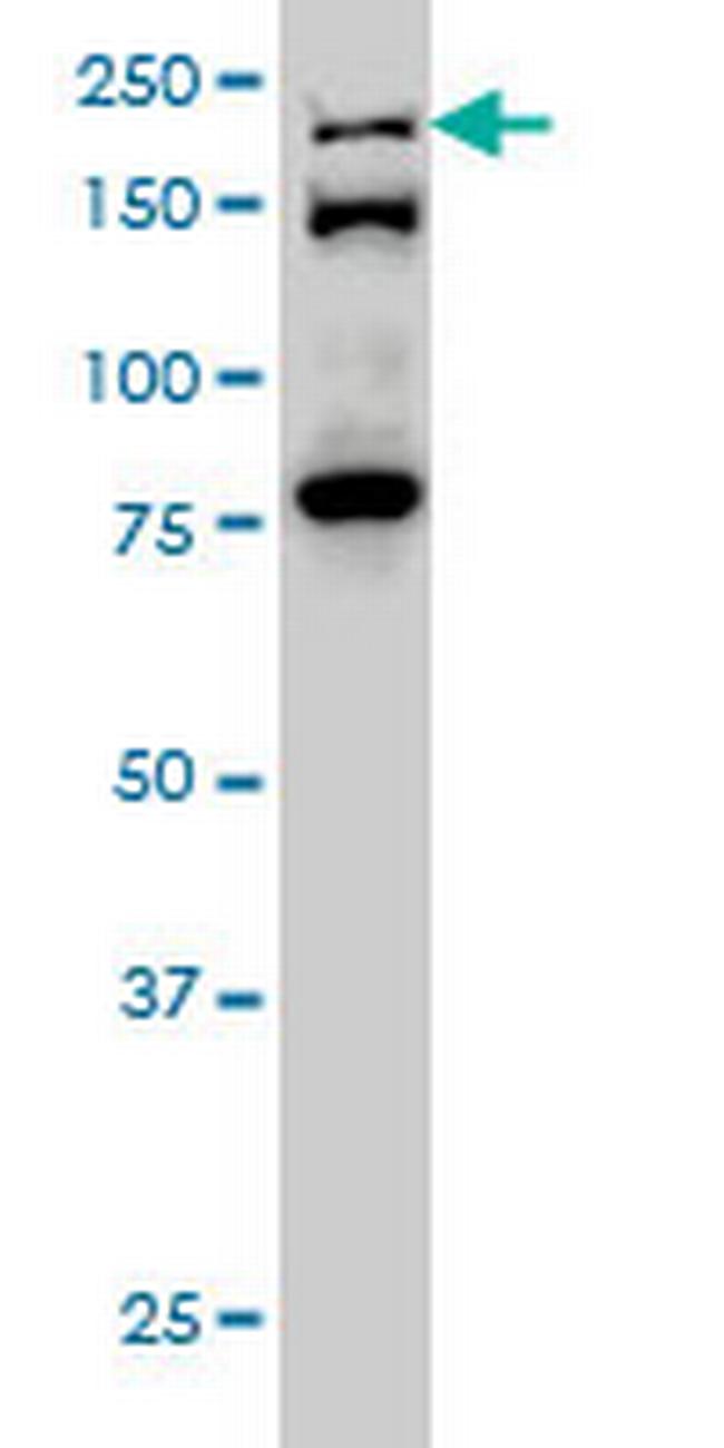 ESPL1 Antibody in Western Blot (WB)