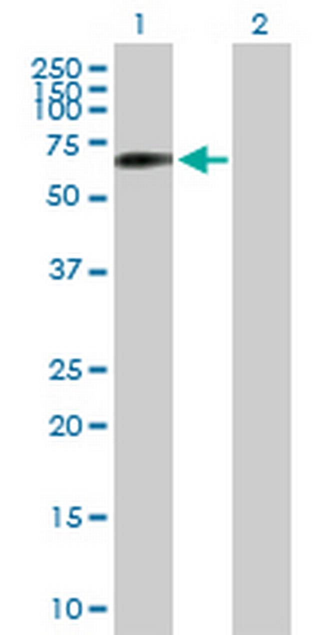 SNPH Antibody in Western Blot (WB)