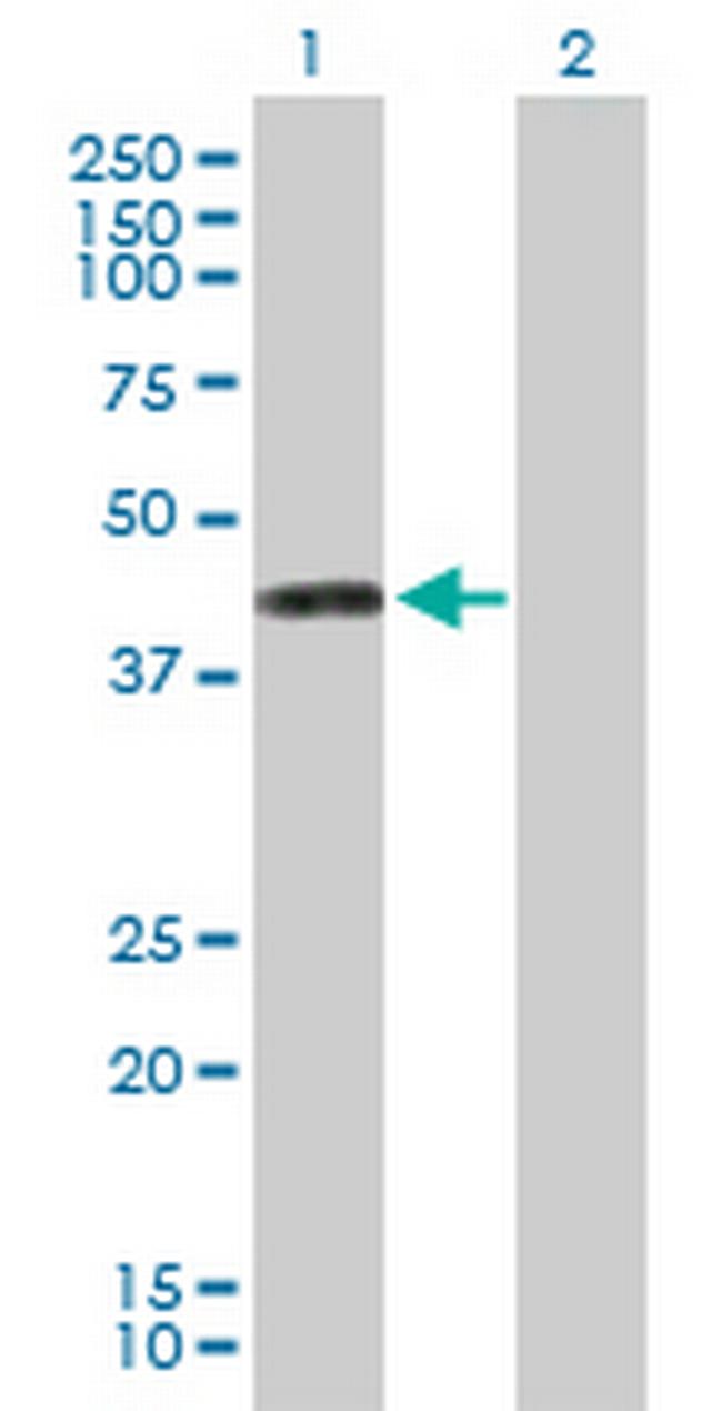 PTDSS1 Antibody in Western Blot (WB)