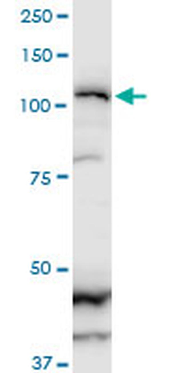 ZFHX1B Antibody in Western Blot (WB)