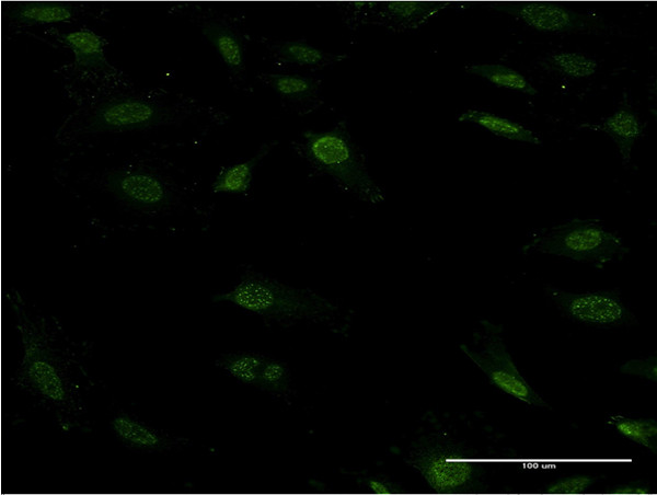 ZFHX1B Antibody in Immunocytochemistry (ICC/IF)