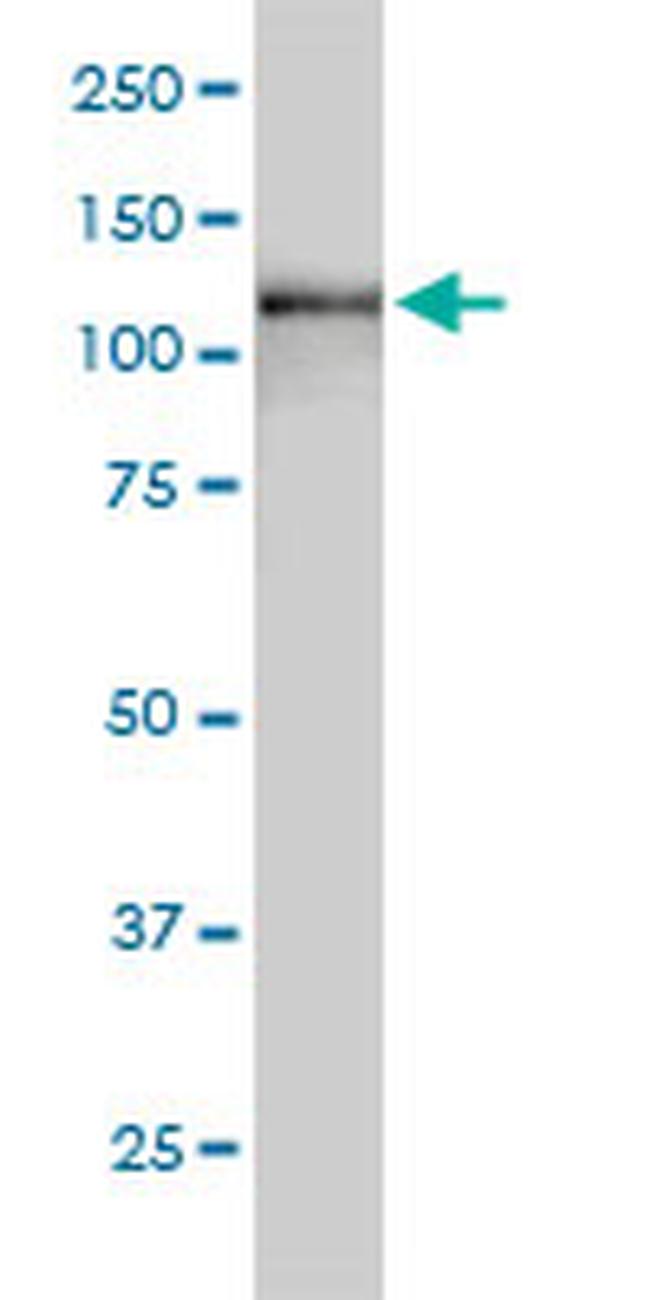 USP15 Antibody in Western Blot (WB)