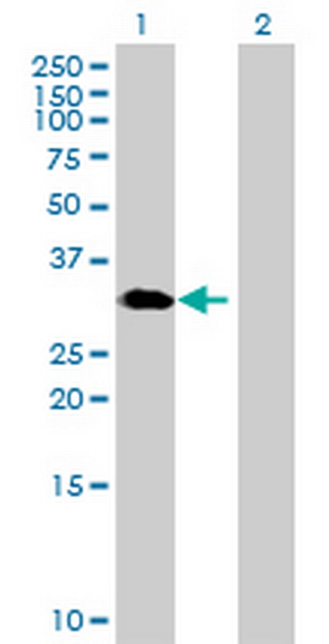 GNPDA1 Antibody in Western Blot (WB)