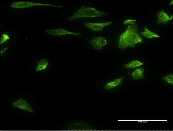 HDAC6 Antibody in Immunocytochemistry (ICC/IF)