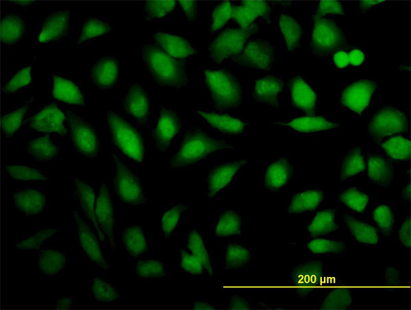 THRAP5 Antibody in Immunocytochemistry (ICC/IF)