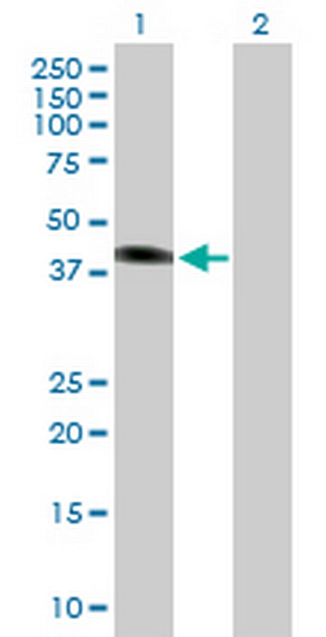 SGK2 Antibody in Western Blot (WB)