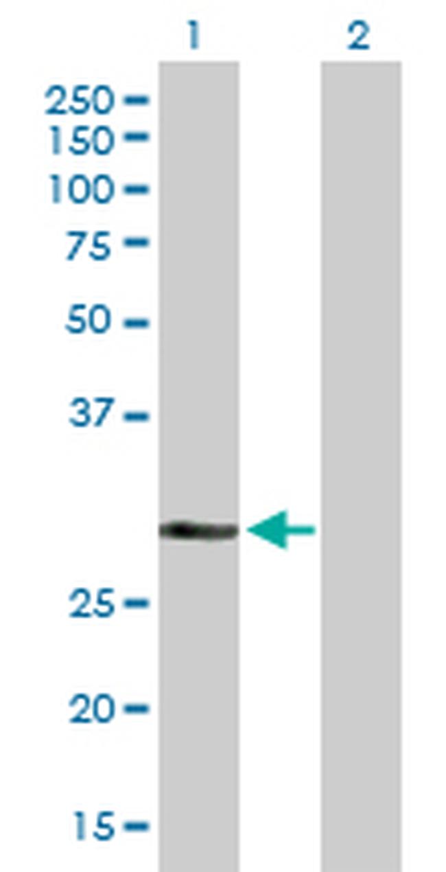 DHRS9 Antibody in Western Blot (WB)